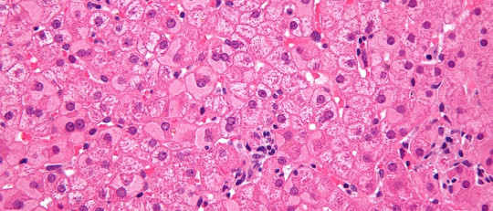 Hepatocitos