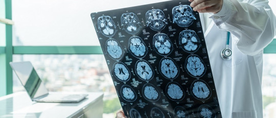 Encefalitis límbica