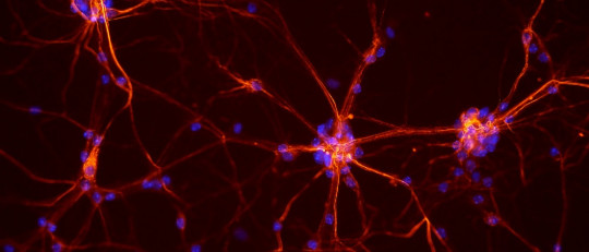 Ley de Hebb: la base neuropsicológica del aprendizaje