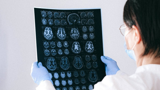 ¿Qué daños al cerebro causan las drogas?