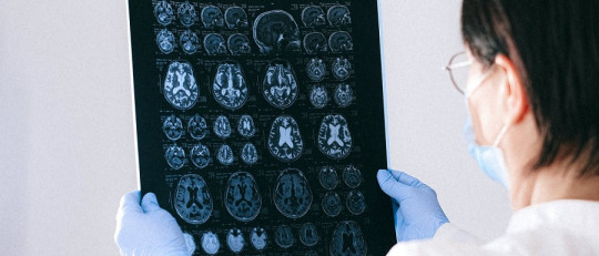 ¿Qué daños al cerebro causan las drogas?