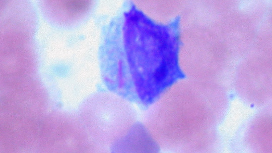 Leucoblastos