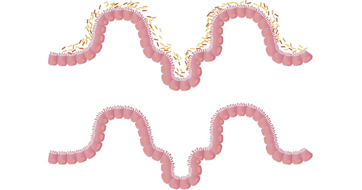 Flora intestinal qué es, características y funciones