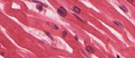 Fibra muscular