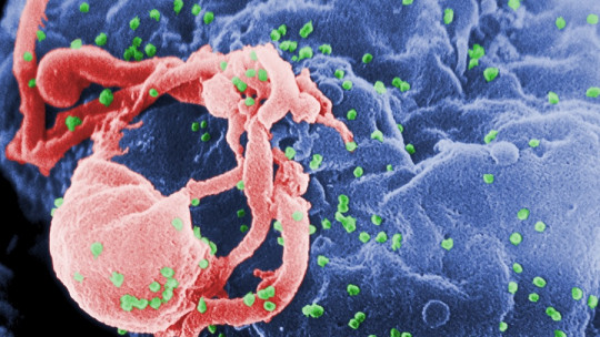 ¿Puede el VIH modificar el comportamiento humano?
