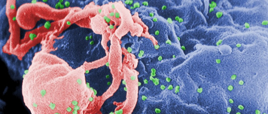 ¿Puede el VIH modificar el comportamiento humano?