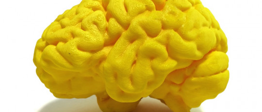 Los 4 tipos de fallos de la memoria: así nos traicionan los recuerdos