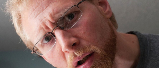 Amnesia global transitoria: síntomas y causas