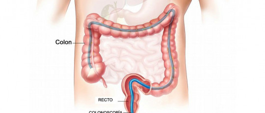 Colonoscopia: ¿para qué se usa esta prueba médica?
