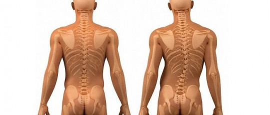 5 ejercicios básicos para prevenir y curar la escoliosis