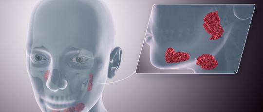 Glándulas salivales