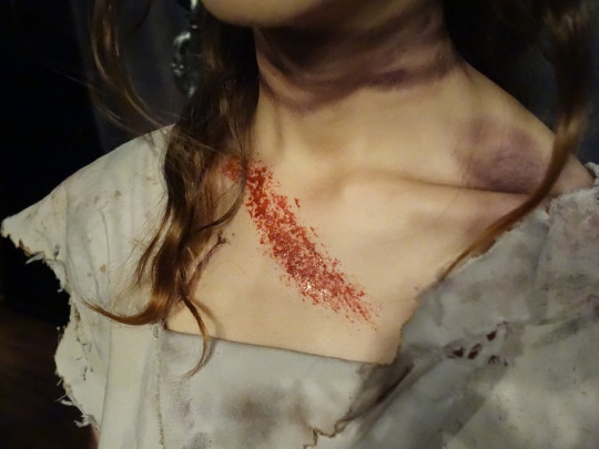 Las 4 diferencias entre violación y abuso sexual