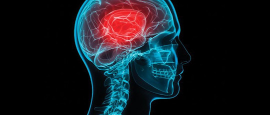 Confabulaciones: definición, causas y síntomas frecuentes