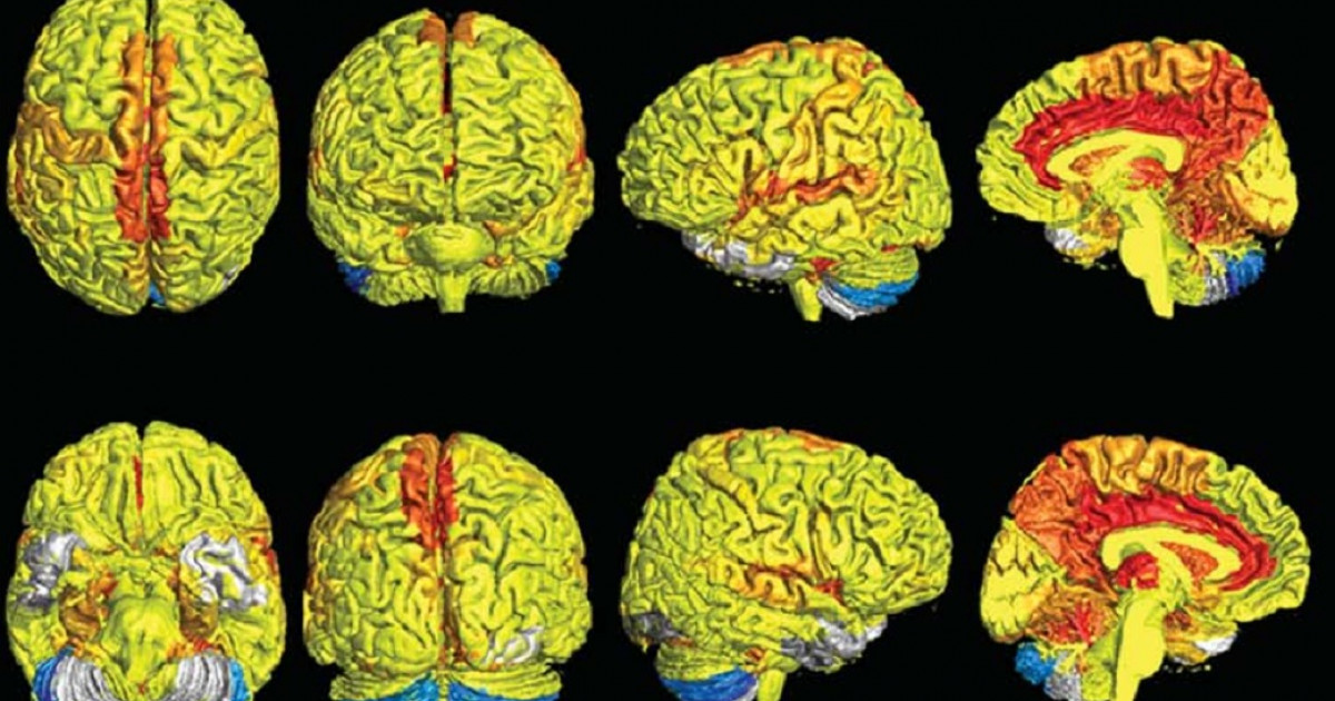 More brains. Полушария мужчины и женщины. Сравнение мужской и женский мозг анатомия. Размер мужского и женского мозга. Женский мозг.