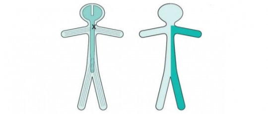 Hemiparesia: tipos, síntomas, causas y tratamiento