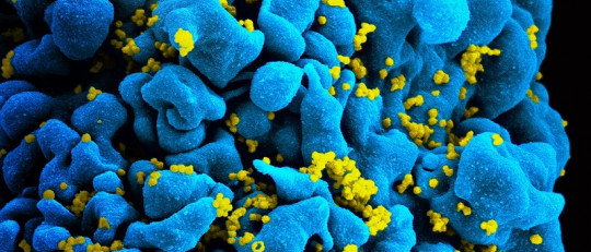 Cómo es vivir con VIH