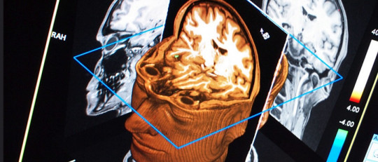Circuito de anti-recompensa