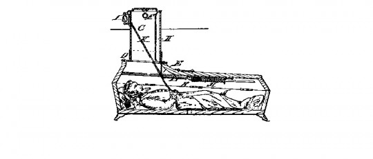 Catalepsia: qué es, síntomas, causas y trastornos asociados